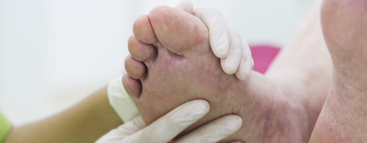 pie diabético aparece cuando existen niveles inadecuados de glucosa- hormigueo, ardor o dolor en los pies. Tratamientos a pies diabéticos.